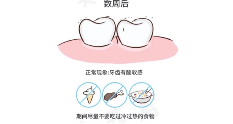 洗牙损伤牙齿别听牙医忽悠,洗牙把黑线洗掉有危害吗