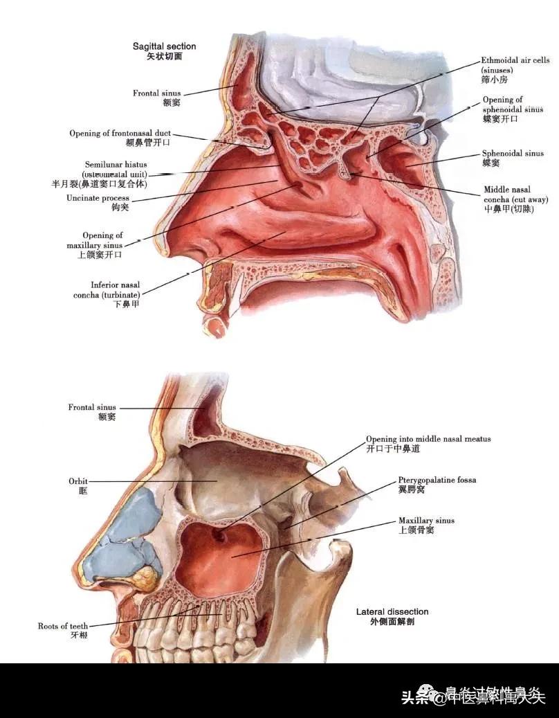 鼻窦炎脓鼻涕绿色头疼,慢性鼻窦炎鼻涕有血怎么办