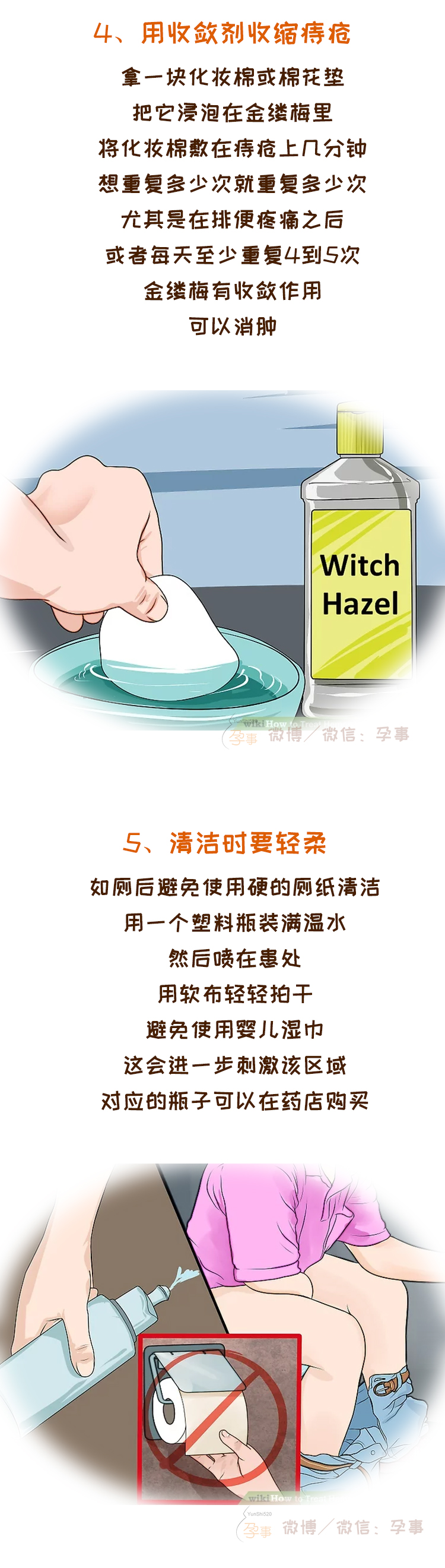 产后痔疮脱出严重肿大疼痛怎么办,产后痔疮大便干燥拉不出来怎么办