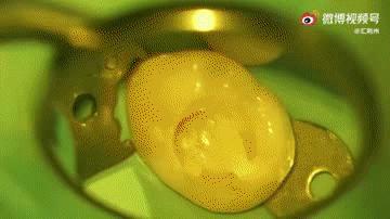 牙齿上有黑点可怕吗,牙齿上有小黑点原来这么可怕