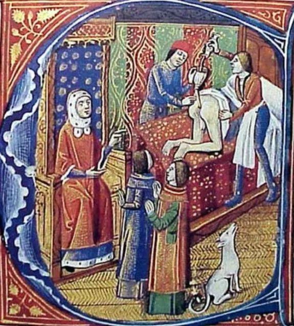 放血疗法西方,古代西方放血疗法有用吗