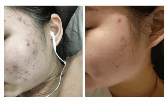 每周一次精准有效的皮肤管理,选对护肤方法让你做靓丽女神