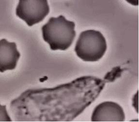基因编辑帮助人类的成功案例,基因编辑是福音吗