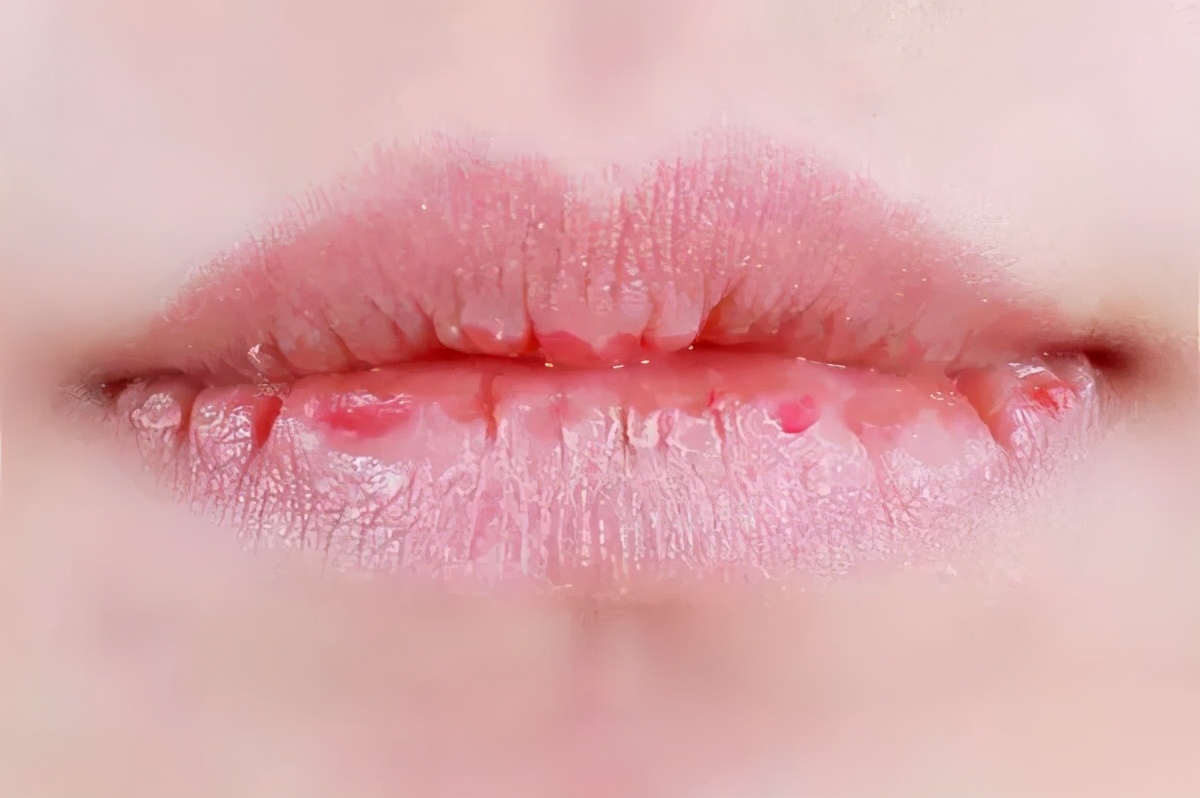 迪丽热巴嘴唇厚,正确脸部护肤步骤迪丽热巴