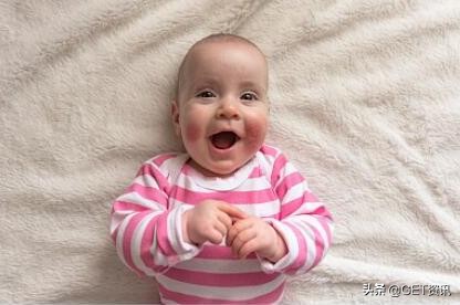 国外宝宝湿疹治疗,澳洲婴幼儿湿疹