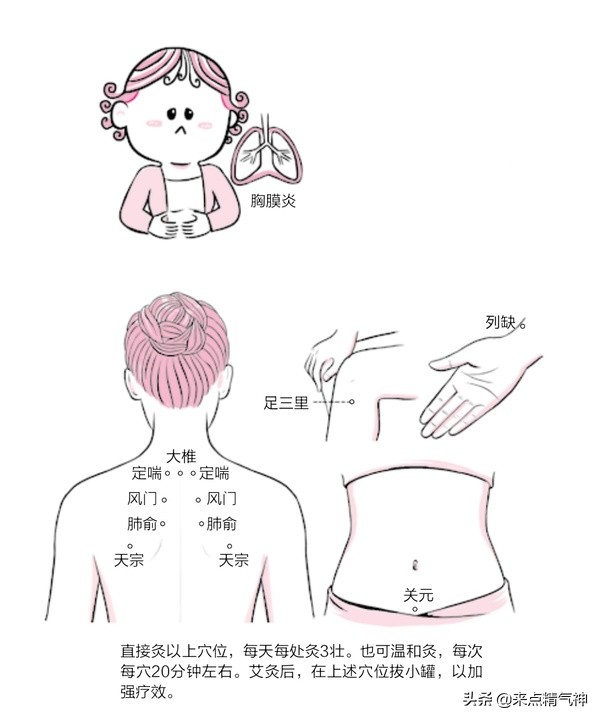 胸膜炎咳嗽排痰是快好了吗,胸闷气短不咳嗽是胸膜炎吗