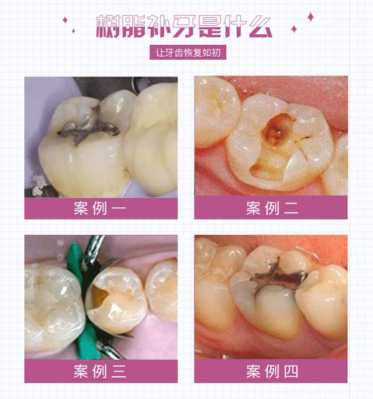 牙齿有黑洞必须修复吗,牙齿有黑洞也不能嚼东西怎么办