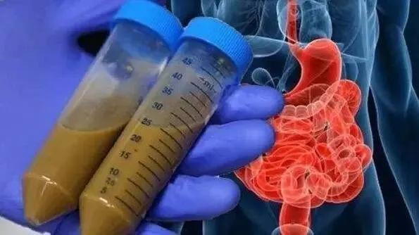 粪便也是救命粮,粪便真的能入药吗