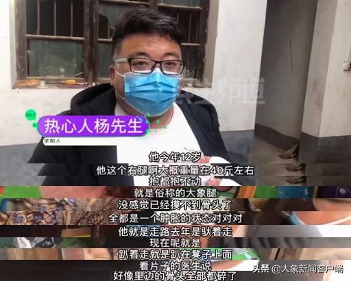 河南12岁“象腿”男孩，可能要面临截肢