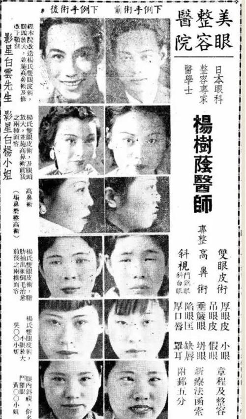 民国才女林徽因割双眼皮,林徽因假才女