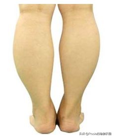 如何告别粗壮小腿,如何消除小腿赘肉