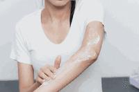 消除脸上皱纹最快方法,眉间皱纹的消除方法