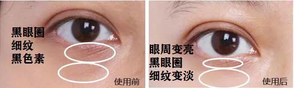去眼纹去黑眼圈用什么方法,去眼袋眼纹公认最好用的土方法