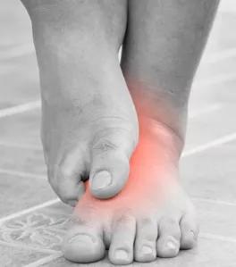 脚被真菌感染水疱型足癣多久才好,真菌足癣可以彻底解决吗