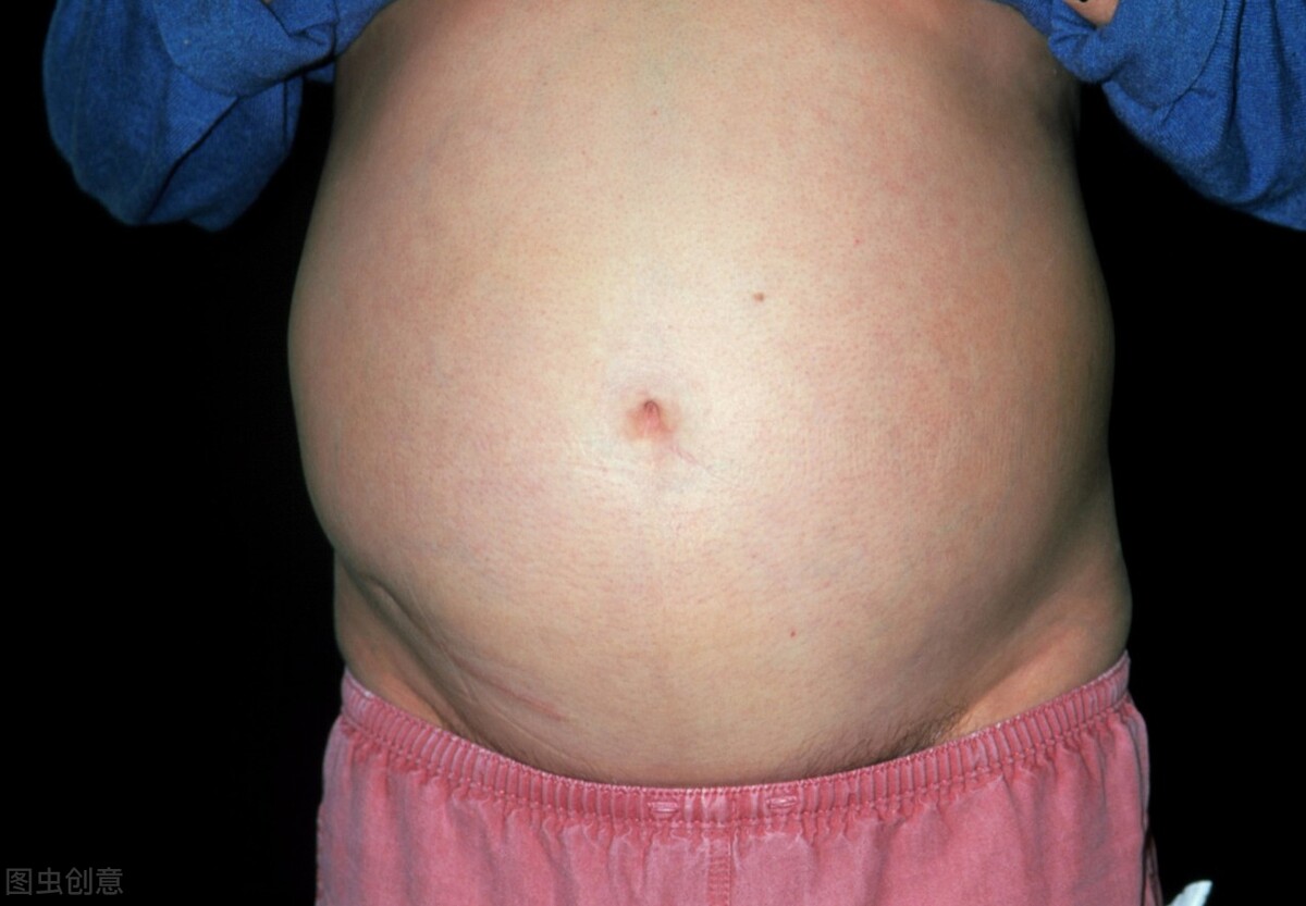 肝癌中晚期症状有哪些,肝癌到中晚期之前会发现什么症状