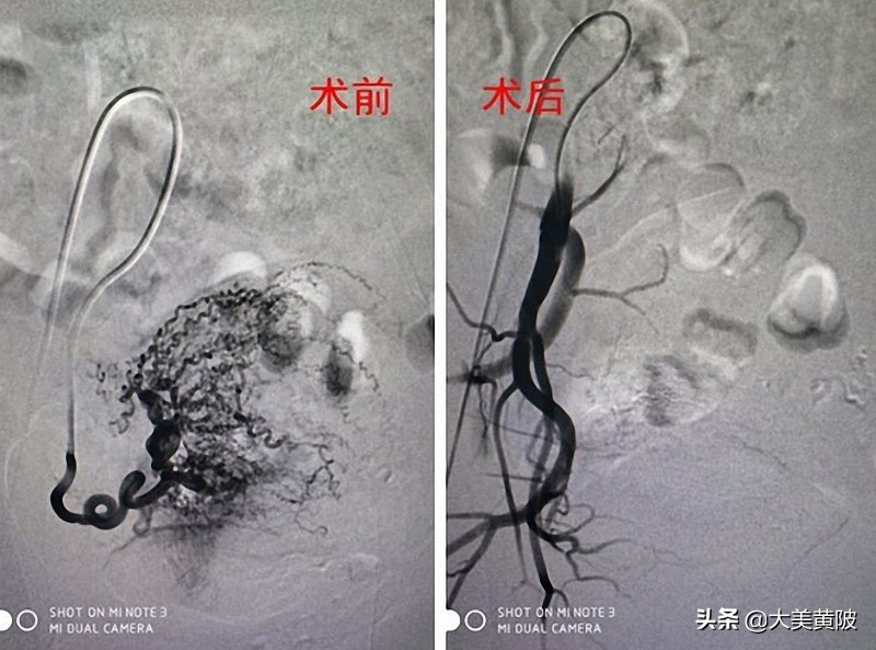 黄陂区人民医院妇产科怎么样,黄陂区人民医院看妇科怎么样