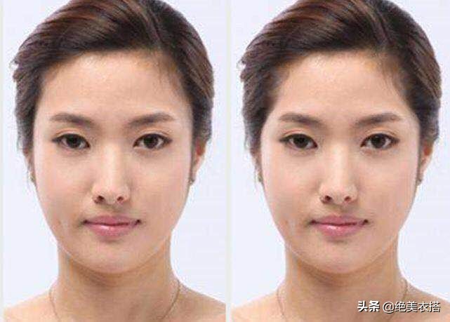 有什么办法改善面部颧骨,颧骨太大可以怎么改善颜值