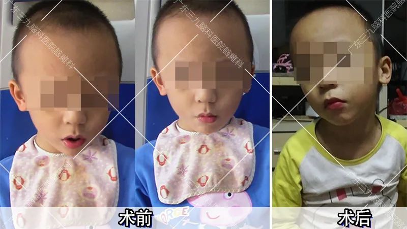 改善言语及认知药,改善记忆力的言语