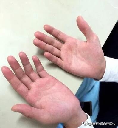 我的行医手记,我的就医日记