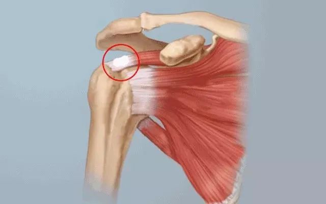 肩痛的原因及症状,突如其来的肩痛实在是难以忍受