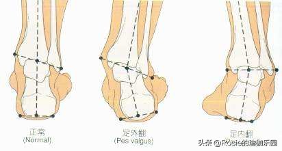 方领衣服肩带老是往下掉怎么办,穿衣服领口老是往下掉