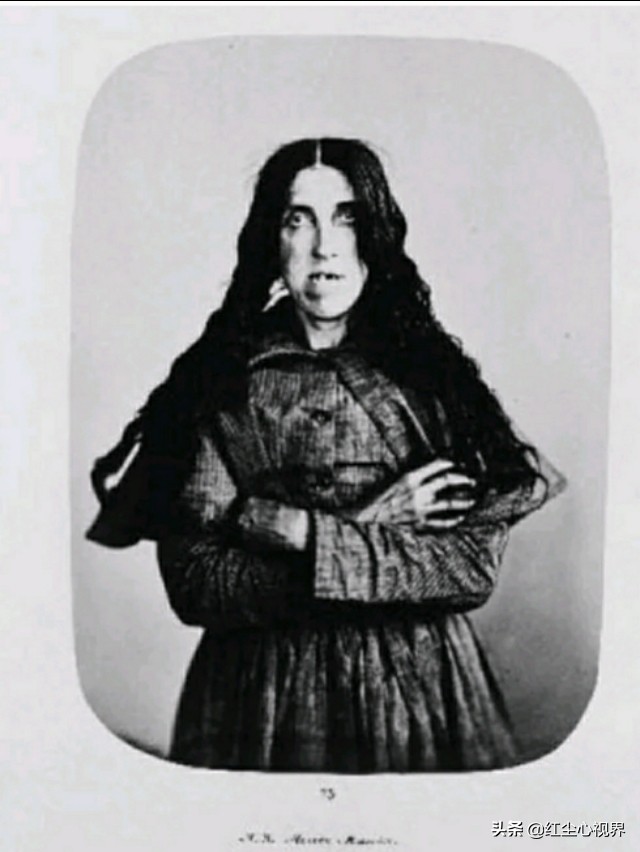 19世纪英国疯人院,疯人院英国