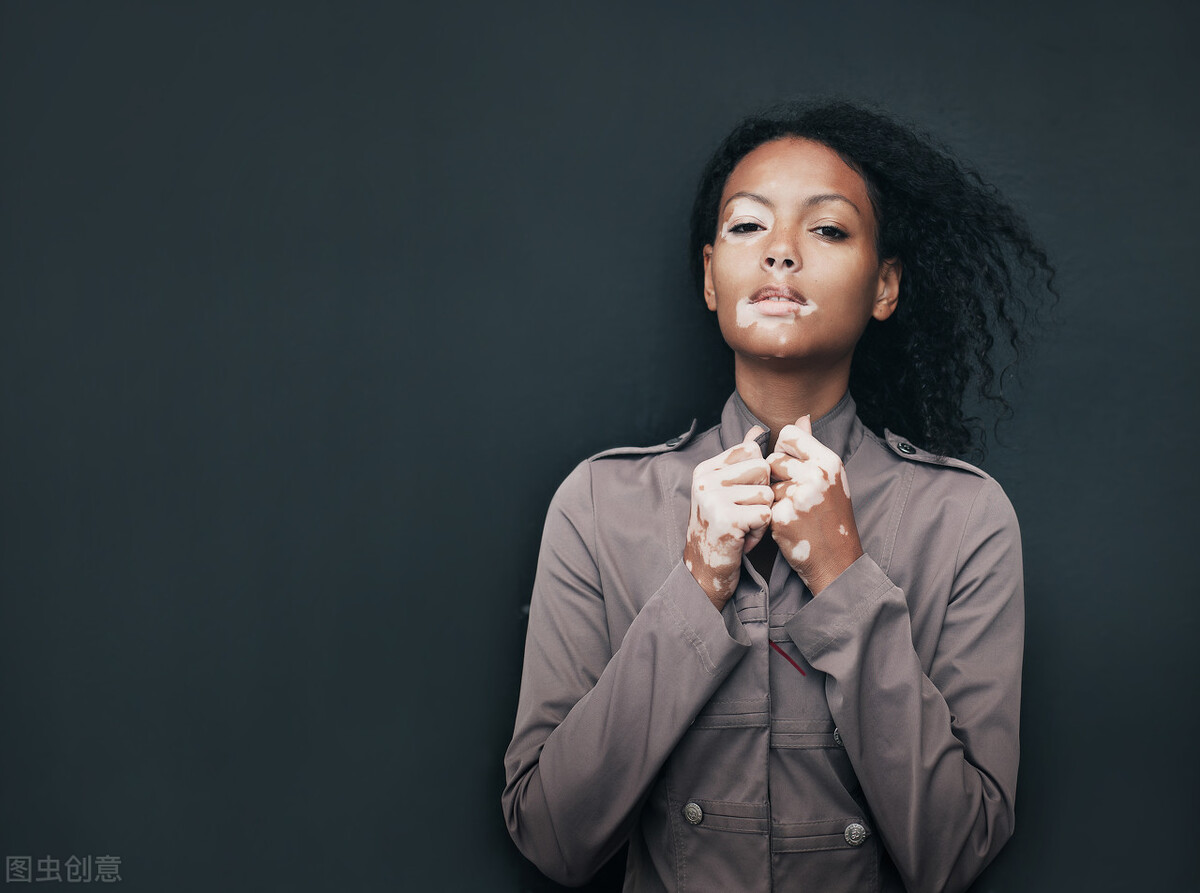 白癜风光疗的危害,白癜风晒太阳的危害