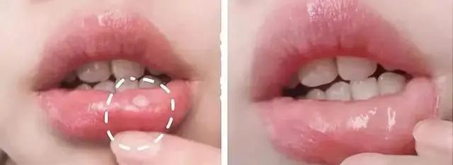 一张嘴臭牙齿就臭怎么办,一张嘴就口臭小妙招