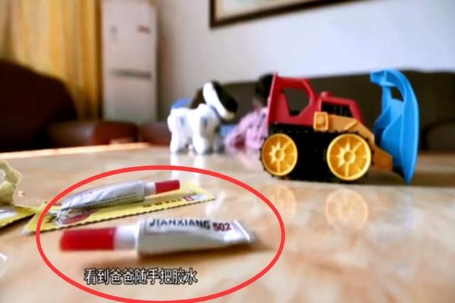 男孩误拿502胶水滴眼睛，爸爸的紧急处理方式，医生称赞：有常识