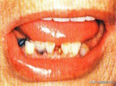 一招教你看舌苔6种舌苔你是哪种,身体好不好看嘴唇就知道了