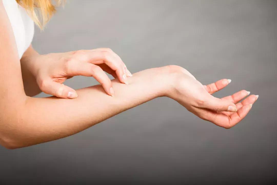 孕期皮肤过敏痒刺痛怎么办,孕期胳膊上起小疙瘩很痒怎么回事