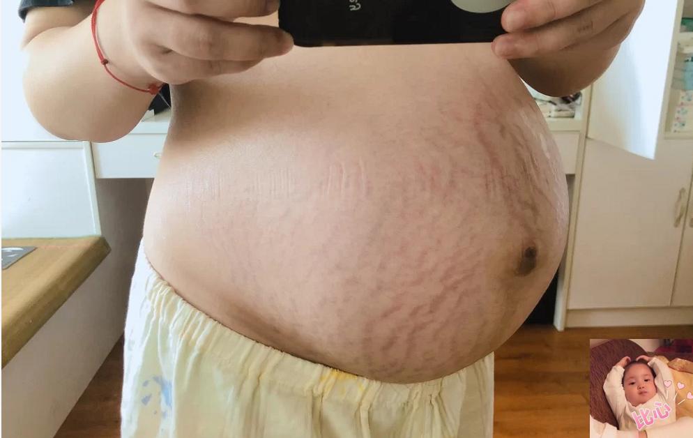 准妈妈肚子,孕早期肚子咕咕响代表什么意思