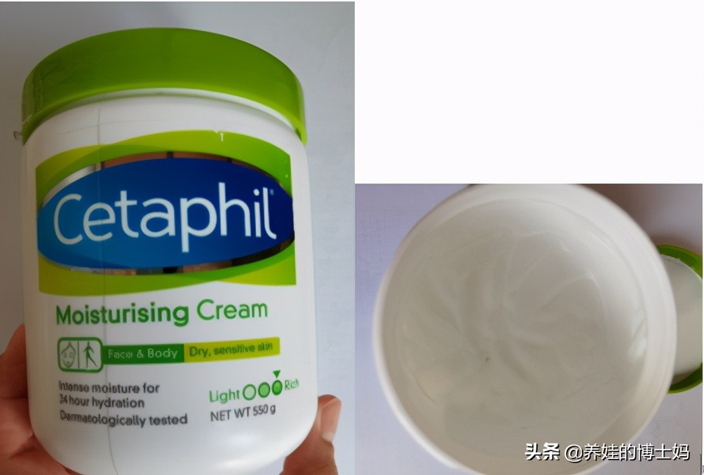 湿疹攻坚战,推荐一款适合宝宝用于湿疹的好物