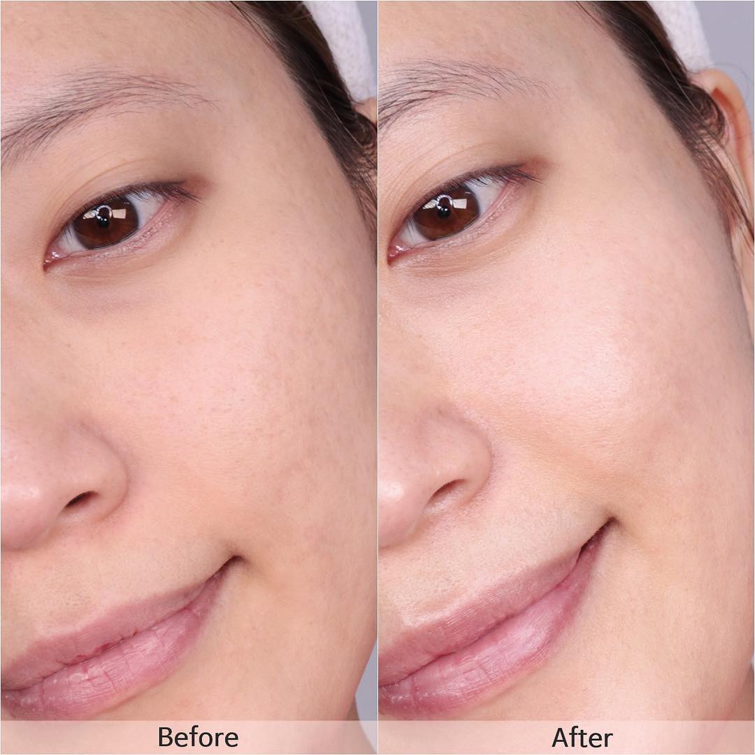 美肤美白护肤神器,城野医生美白精华正确使用方法