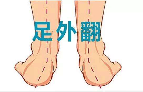2岁小孩膝外翻怎么治,孩子有一点点足外翻怎么矫正