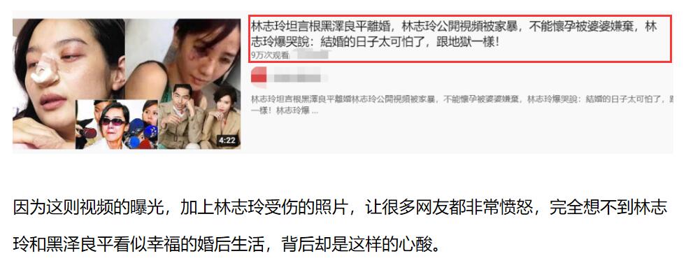 林志玲情人节录视频，鼻子部位疑似有淤青，评论区现神评论