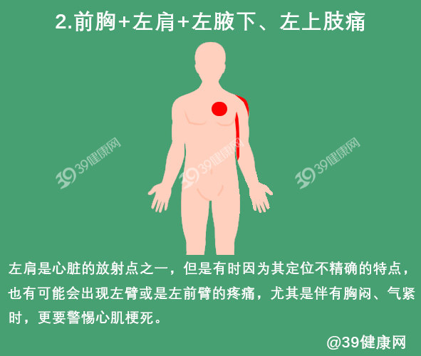 有心肌缺血的症状但是查不出问题,心肌缺血的症状大家一定要注意