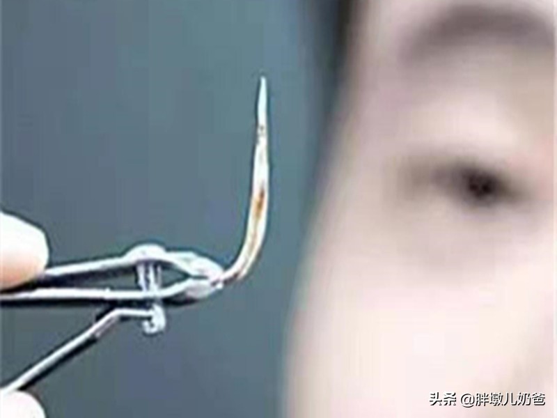 小女孩喉咙卡鱼刺,宝妈卡鱼刺