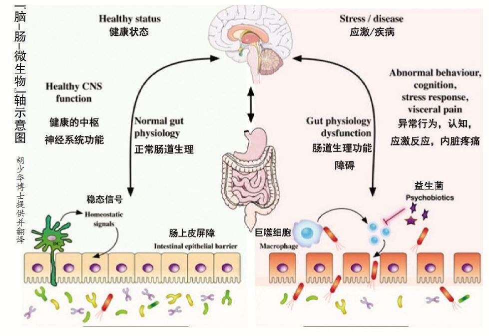 阿尔茨海默病要怎样锻炼,阿尔茨海默症患者拒绝饮食怎么办