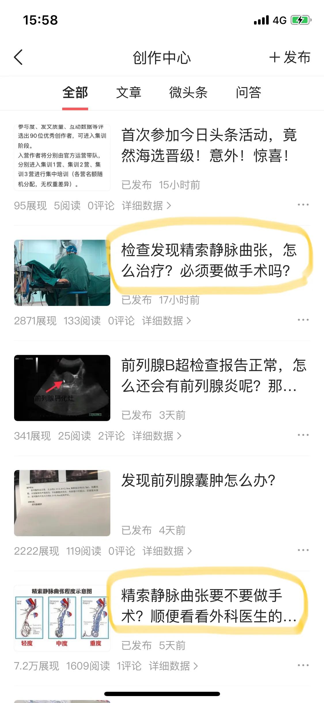 精索静脉曲张诊断与治疗指南,精索静脉曲张到底要不要做手术