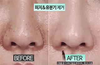 吸黑头神器去粉刺角质收缩毛孔,皮肤清洁收缩毛孔黑头角质