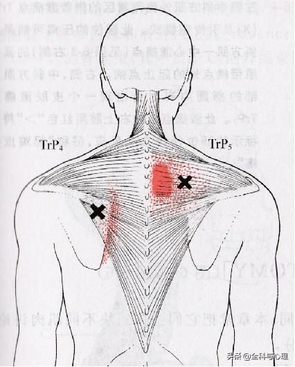 中医如何治疗肩峰损伤,中医治疗软组织损伤案例方剂