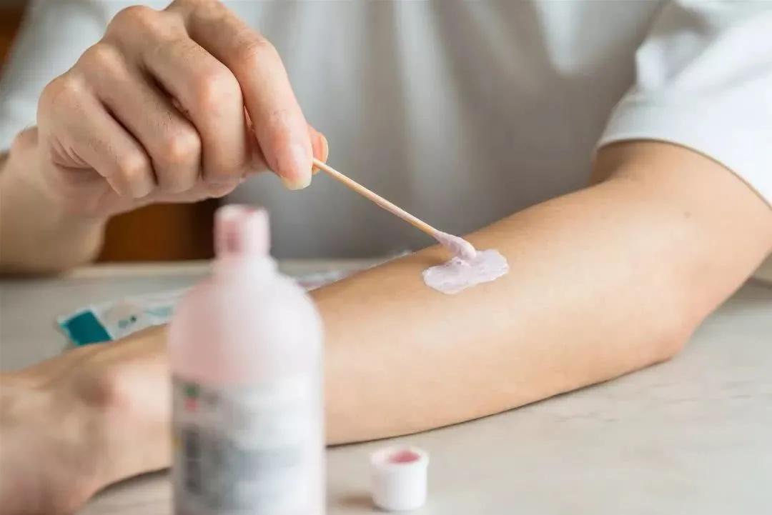 去了海边之后长了小红疹,去海边没暴露的地方起疹子