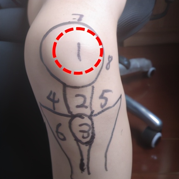 膝盖痛12种疼痛对照表图解,不同部位膝盖疼痛的原因