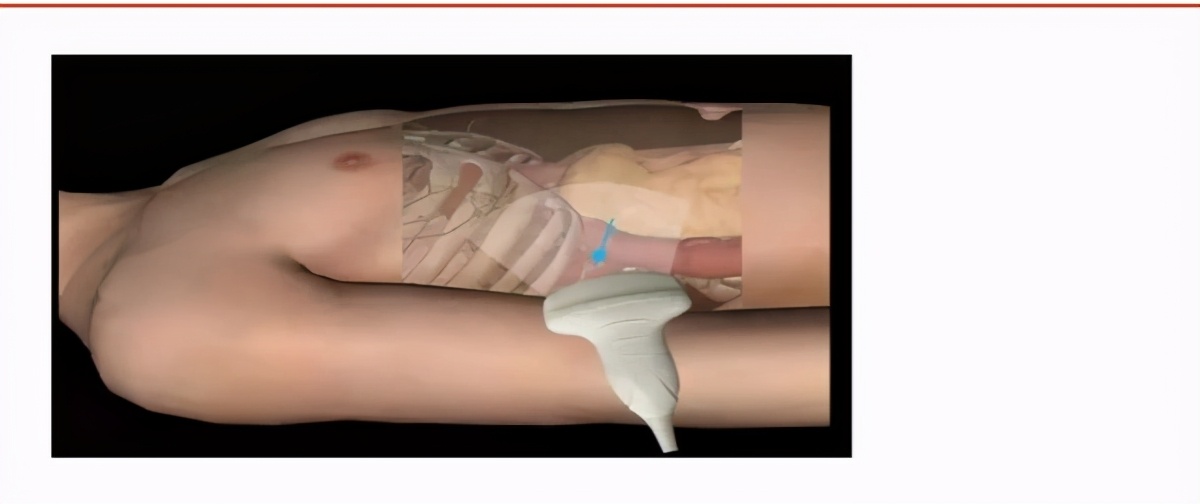 体检医学知识科普,体检检前b超科普视频