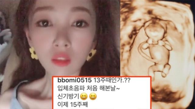 金甫美晒6个月孕肚泳装照与老公甜蜜放闪，曾因贴B超照惹争议