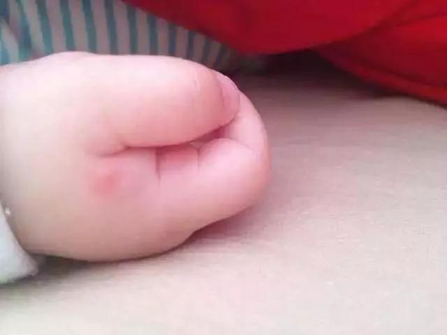防止宝宝夏天蚊子叮咬妙招,蚊子叮咬怎么驱蚊