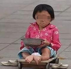 眼球被挖走了还能恢复吗,眼球被挖了还会活着吗