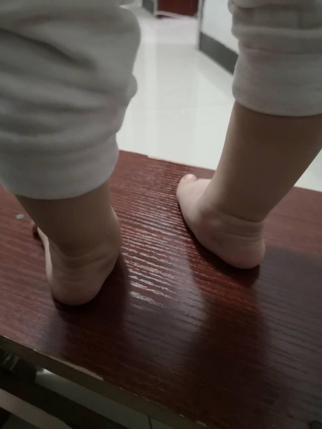 宝宝预防足外翻的矫正方法,新生儿怎么预防足外翻