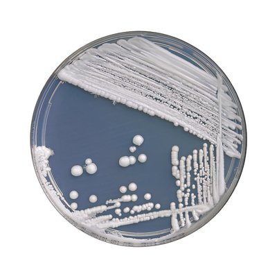 念珠菌用抗生素能好吗,使用抗生素后大便有真菌